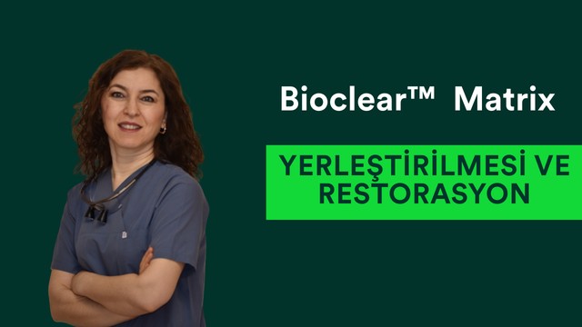 Bioclear™  Matrix Yerleştirilmesi ve Restorasyon