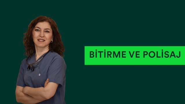 Bitirme ve Polisaj